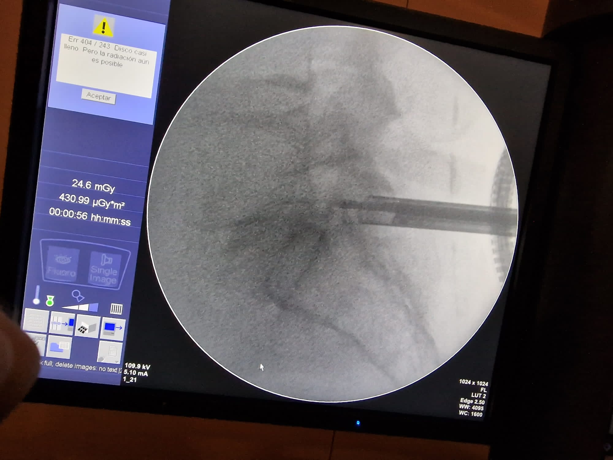 Cirugia endoscópica monoportal